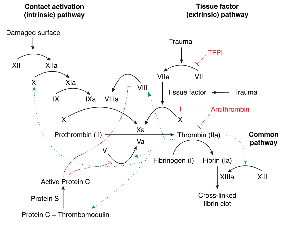 Définition Thrombose des vaisseaux sanguins Hypercoagulation